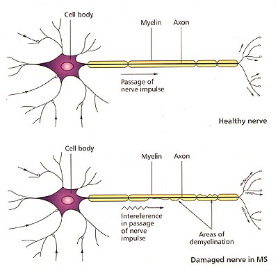 axon2 01